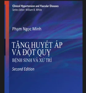 Biến chứng đột quỵ não do bệnh tăng huyết áp