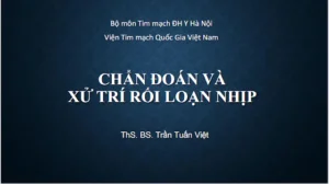 Sơ đồ chẩn đoán và xử trí rối loạn nhịp tim trên lâm sàng