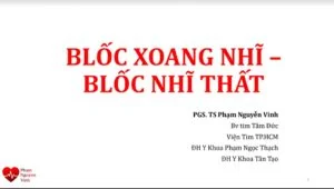 Sơ đồ điện tâm đồ minh họa blốc xoang nhĩ và blốc nhĩ thất
