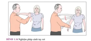 Bác sĩ thực hiện nghiệm pháp cánh tay rơi khám khớp vai cho bệnh nhân