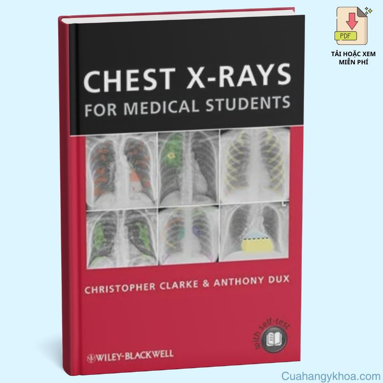 Sách Dịch "Chest X-rays for Medical Students"