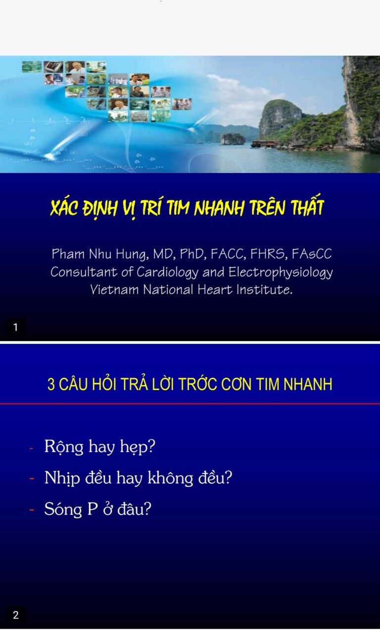 [Tài Liệu] Bài Giảng Khoá Học Điện Tâm Đồ – Hội Tim Mạch Việt Nam