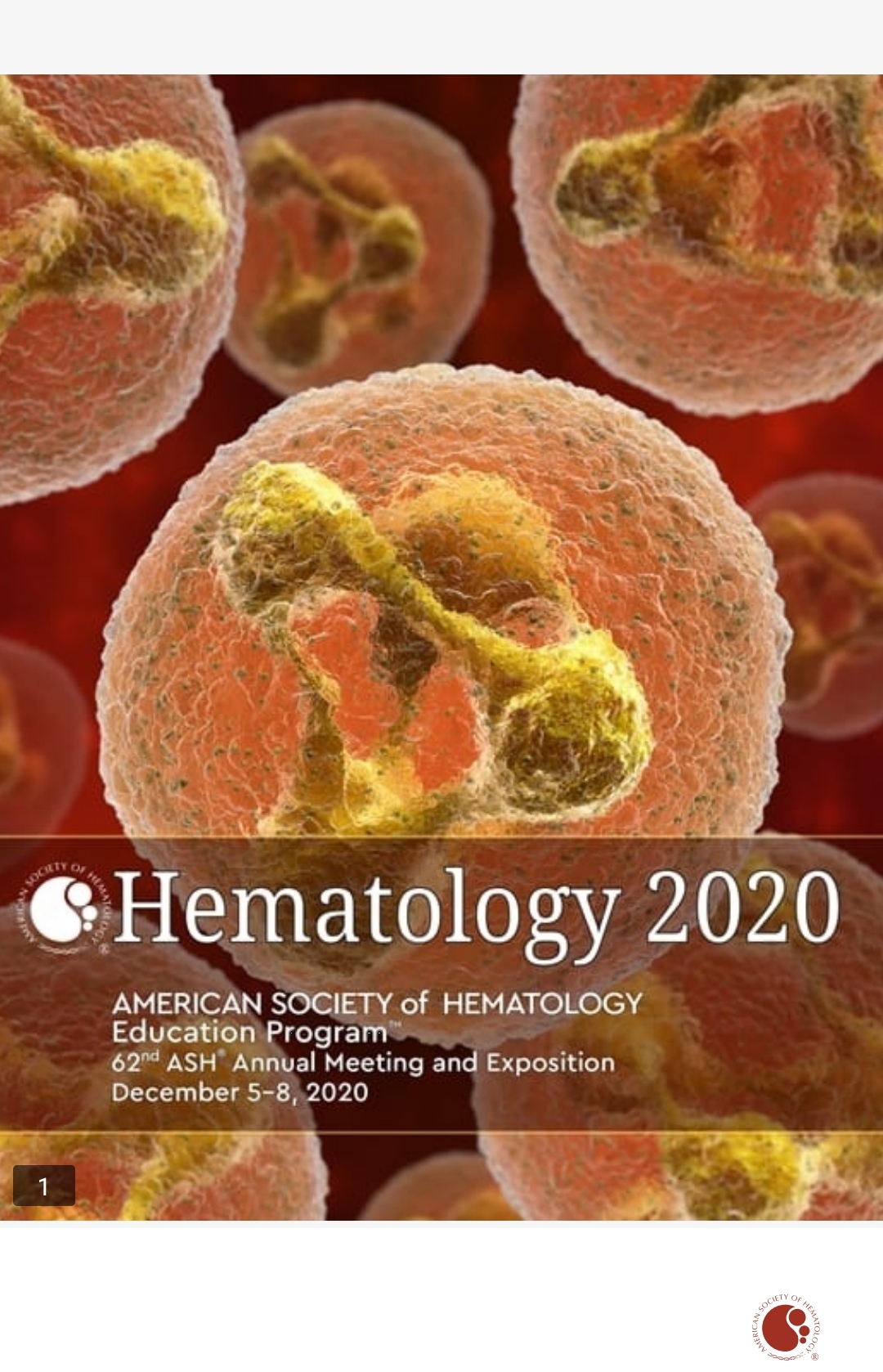 Download Book "Hematology 2020 AMERICAN SOCIETY OF HEMATOLOGY EDUCATION