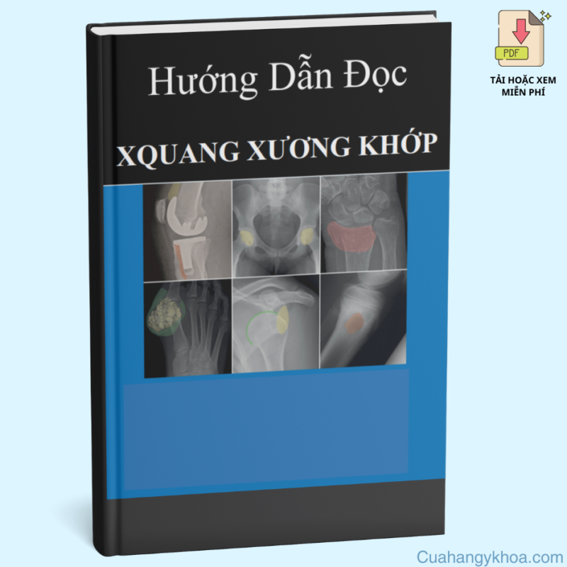 Hướng Dẫn Đọc X-Quang Xương Khớp: Cẩm Nang Thiết Yếu Cho Chẩn Đoán Hình Ảnh