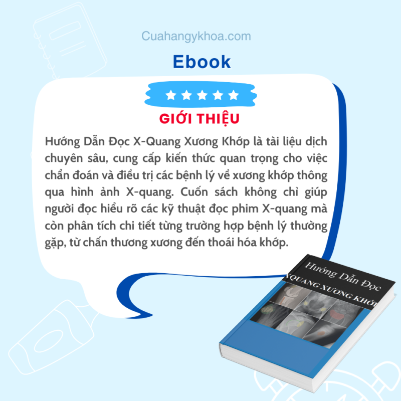 Hướng Dẫn Đọc X-Quang Xương Khớp: Cẩm Nang Thiết Yếu Cho Chẩn Đoán Hình Ảnh