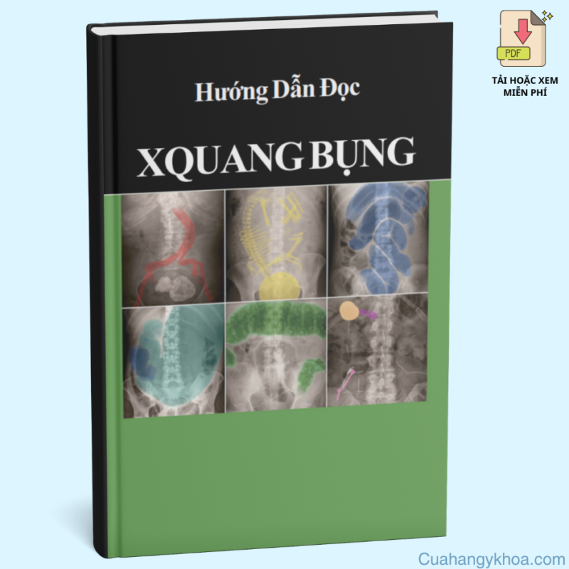 Hướng Dẫn Đọc X-Quang Bụng