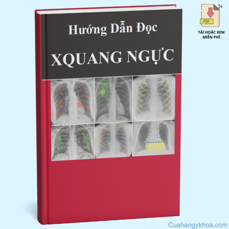 Hướng Dẫn Đọc X-Quang Ngực