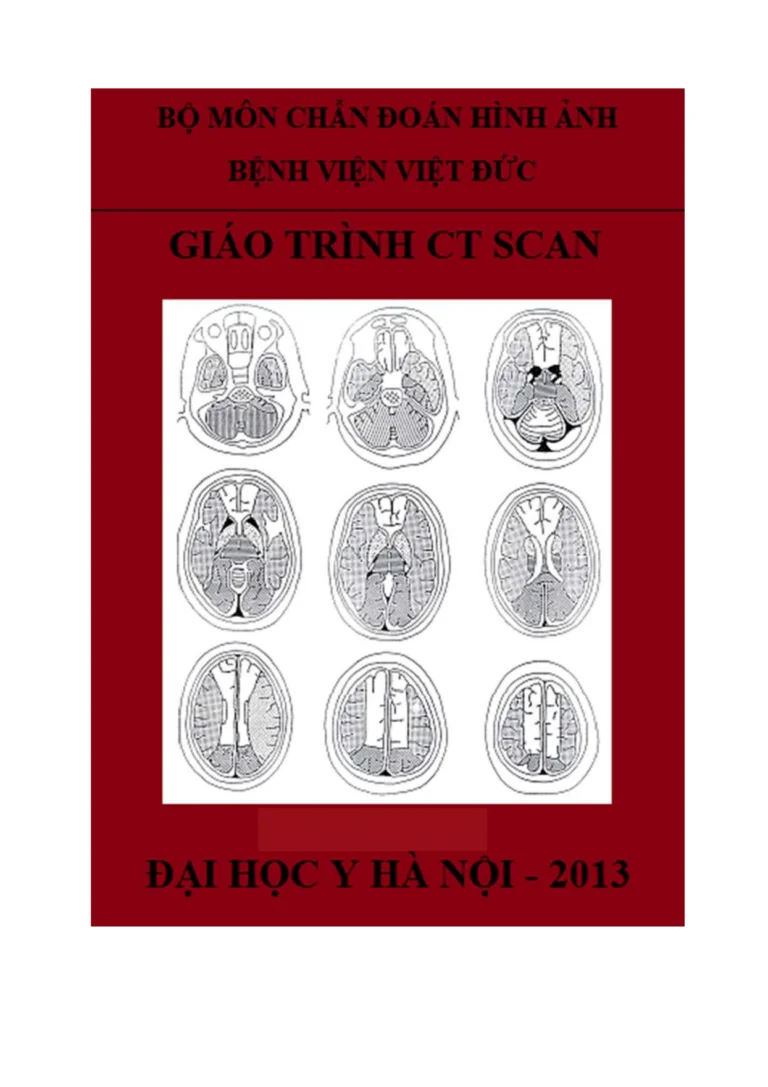 Tải Tài Liệu “Giáo Trình CT-Scan Bệnh Viện Việt Đức”