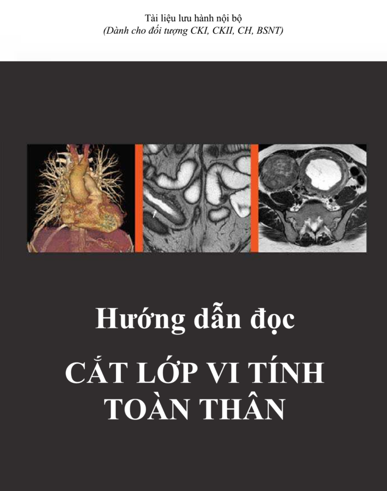 [Tài Liệu Dịch] Hướng Dẫn Đọc Cắt Lớp Vi Tính Toàn Thân