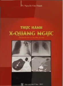 Bìa sách hoặc minh họa tài liệu thực hành x quang ngực