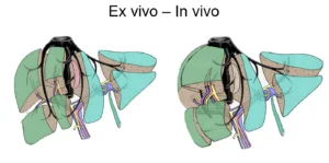 Sách giải phẫu gan và đường mật về phương diện phẫu thuật