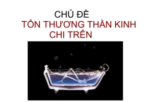 Tai lieu ton thuong than kinh chi tren