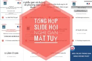 Tai lieu slide hoi nghi ngoai khoa gan mat tuy pdf