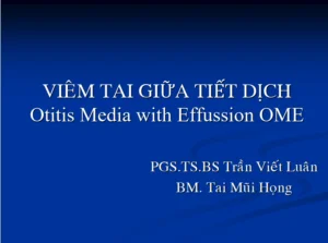 Tài liệu slide viêm tai giữa tiết dịch PDF
