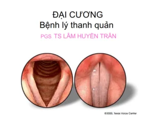 Tai lieu dai cuong benh ly thanh quan