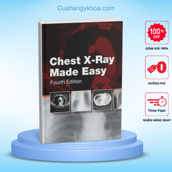 Chest X-Ray Made Easy 4e