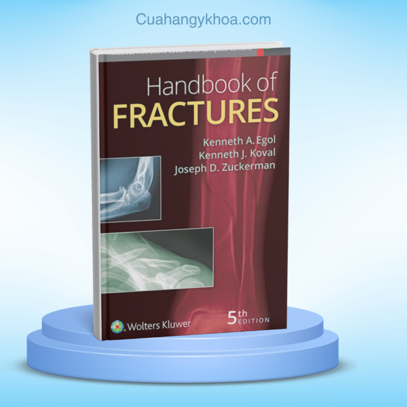 Handbook of Fractures 5e