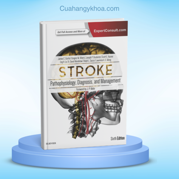 Stroke Pathophysiology Diagnosis and Management 6e