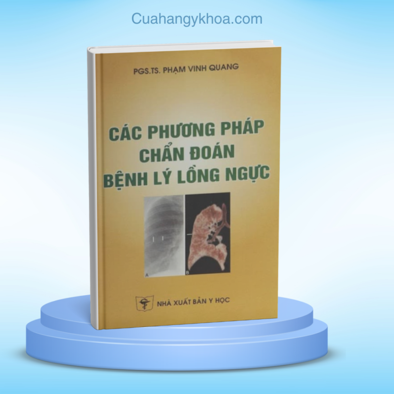 cac phuong phap chan doan benh ly long nguc