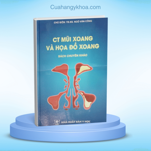 CT mui xoang va hoa do xoang