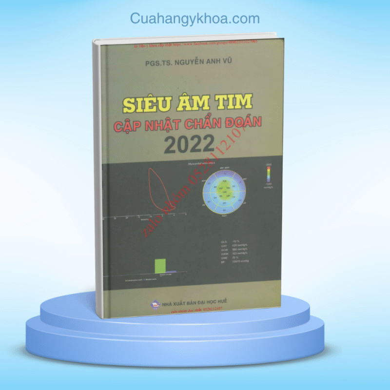 Sieu am tim cap nhat chuan doan 2022