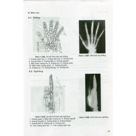 Sách - Giải phẫu X-quang