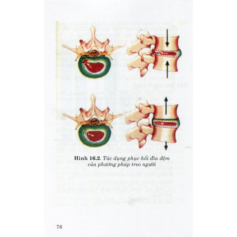 Xoa bóp bấm huyệt chữa các bệnh vùng cột sống