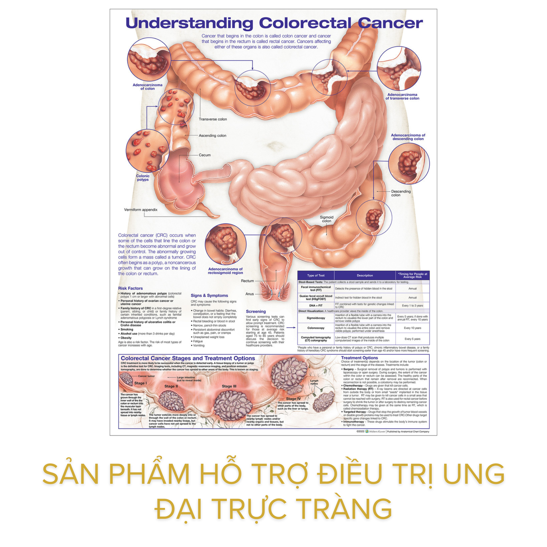 Sản phẩm hỗ trợ điều trị ung ĐẠi trực tràng