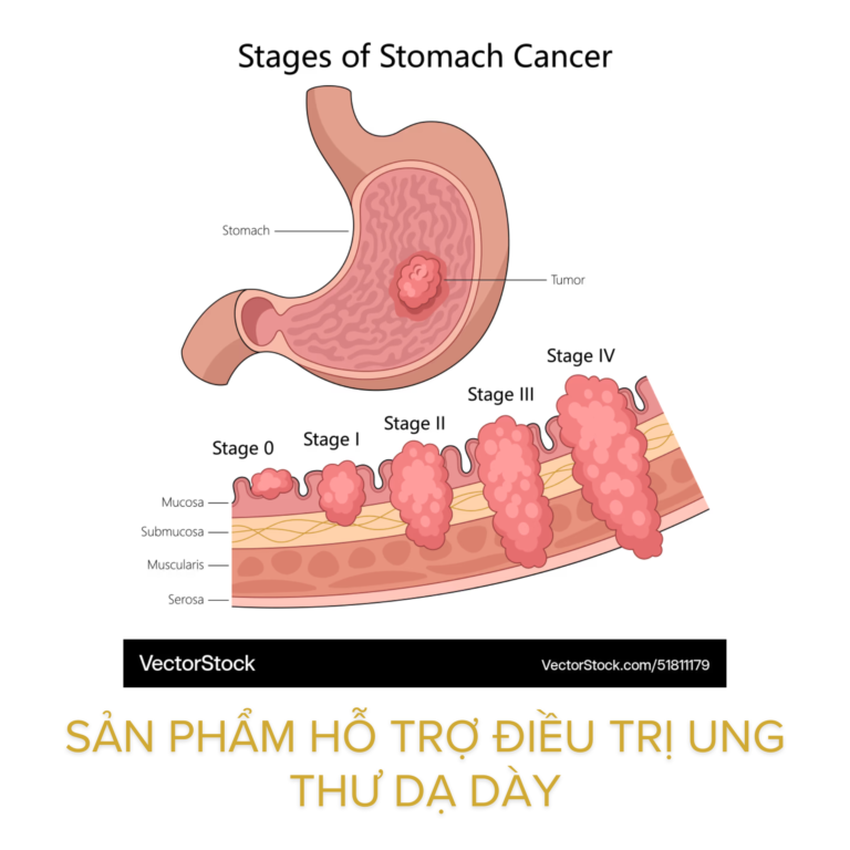 Sản phẩm hỗ trợ điều trị ung thư dạ dày tăng cường miễn dịch