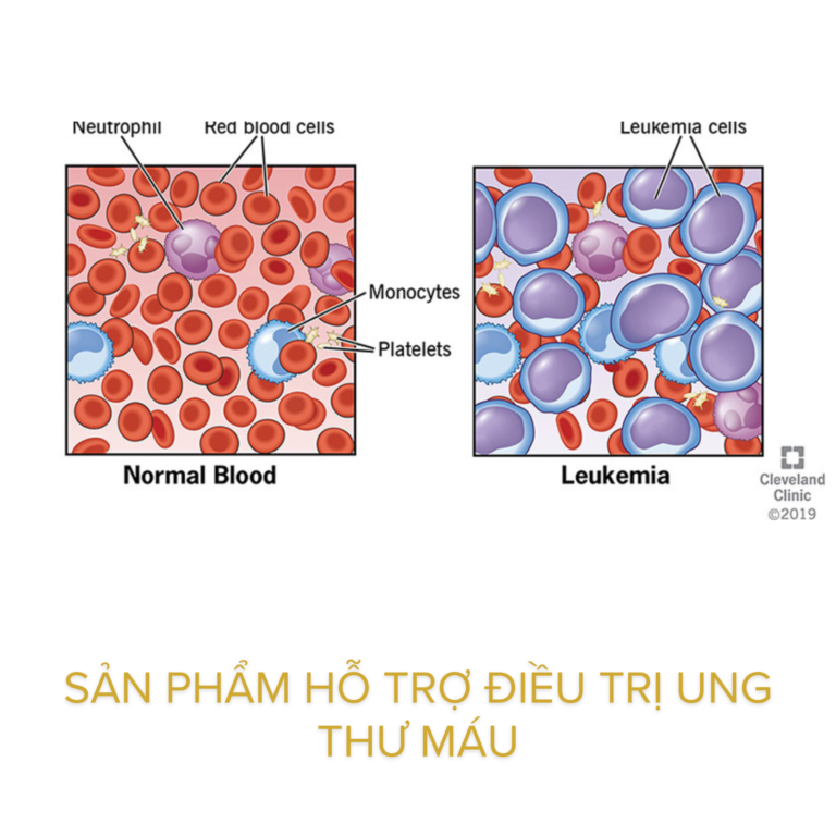 Sản phẩm hỗ trợ điều trị ung thư máu giúp nâng cao thể trạng