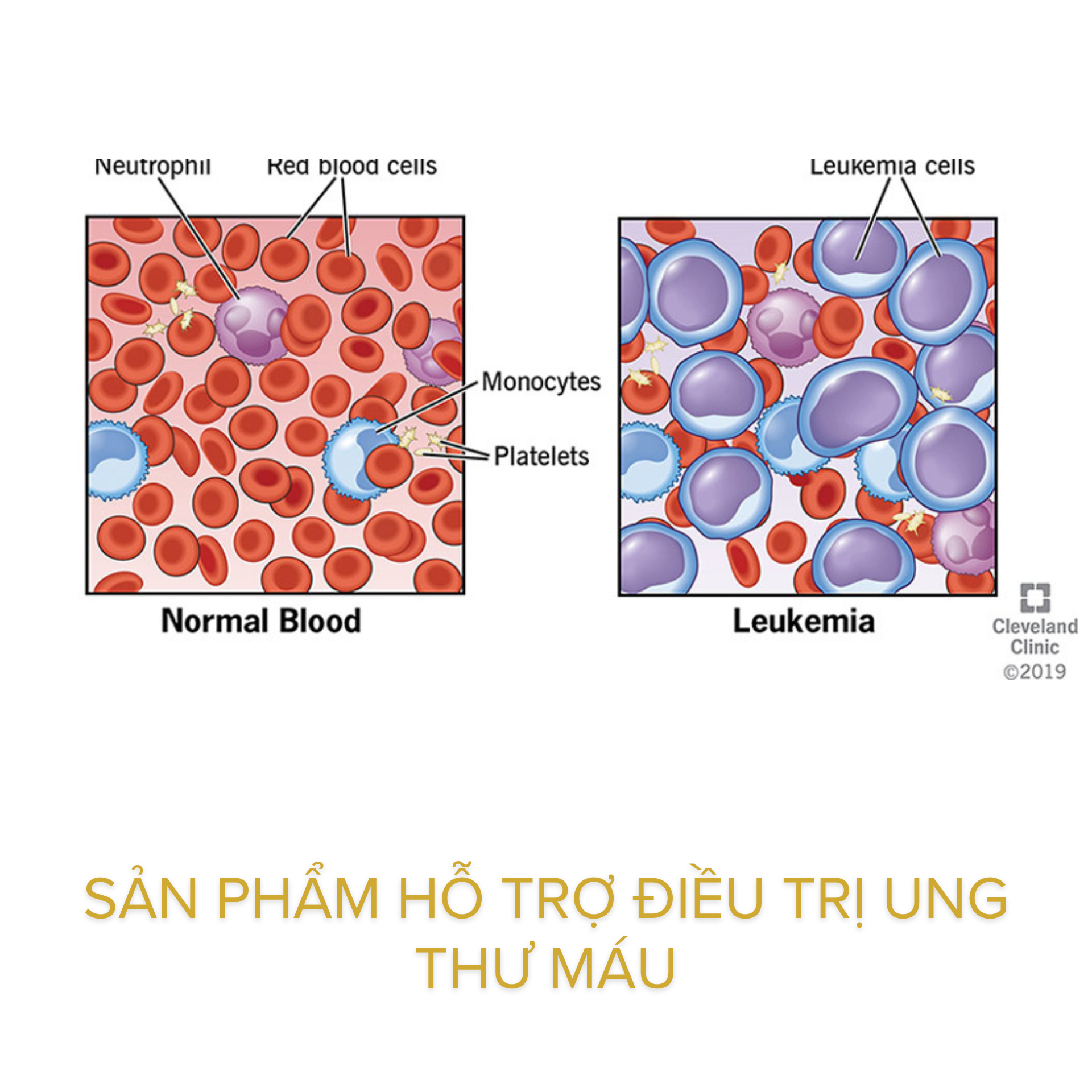 Sản phẩm hỗ trợ điều trị ung thư máu