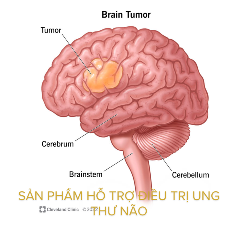 Sản phẩm hỗ trợ điều trị ung thư não: Giải pháp dinh dưỡng