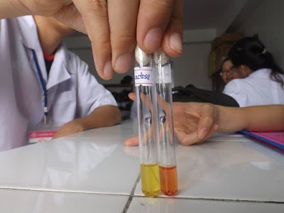 Hình ảnh thực hành Vi sinh nhuộm Gram và nuôi cấy vi khuẩn trong phòng thí nghiệm