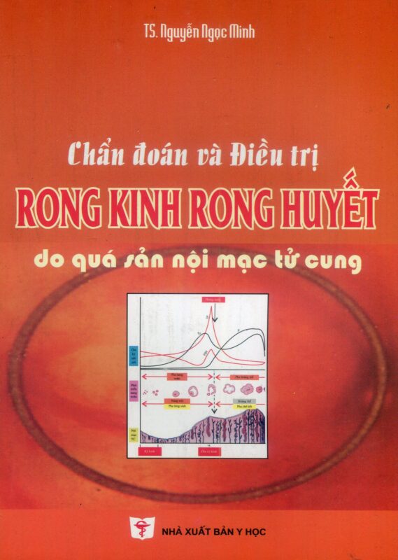 Chẩn đoán và điều trị rong kinh rong huyết do quá sản nội mạc tử cung bản giấy